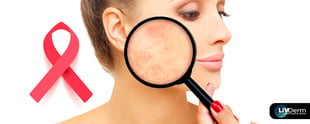 April is Rosacea Awareness Month