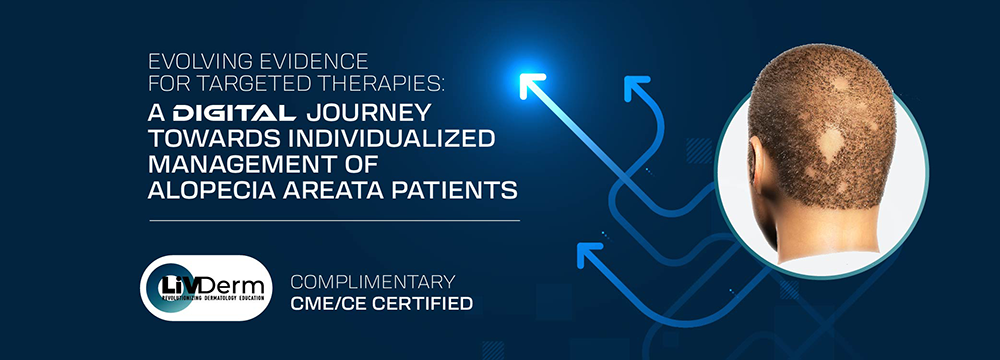 Evolving Evidence for Targeted Therapies: A Digital Journey Towards Individualized Management of Alopecia Areata Patients