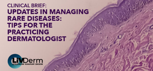 Clinical Brief: Updates in Managing Rare Diseases: Tips for the Practicing Dermatologist