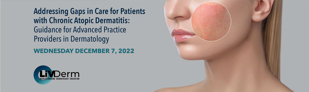 Addressing Gaps in Care for Patients with Chronic Atopic Dermatitis: Guidance for the Advanced Practice Providers in Dermatology - Wednesday, Dec. 7