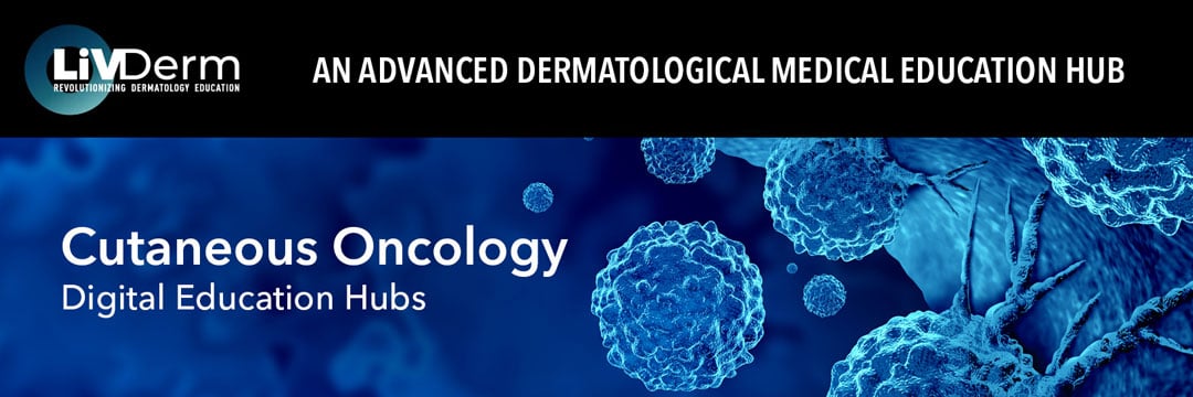 Cutaneous Oncology Digital Education Hub