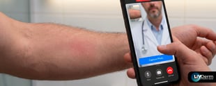 Direct-to-Consumer Dermatology
