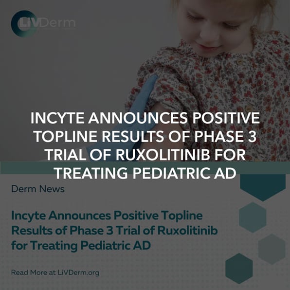 Incyte Announces Positive Topline Results of Phase 3 Trial of Ruxolitinib for Treating Pediatric AD