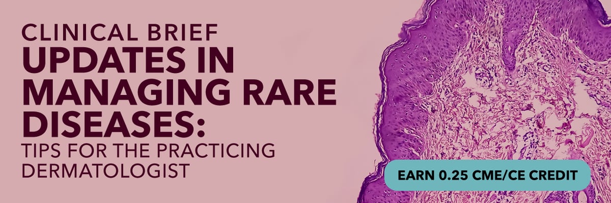 Clinical Brief: Updates in Managing Rare Diseases: Tips for the Practicing Dermatologist