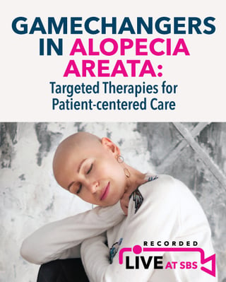 Gamechangers in Alopecia Areata
