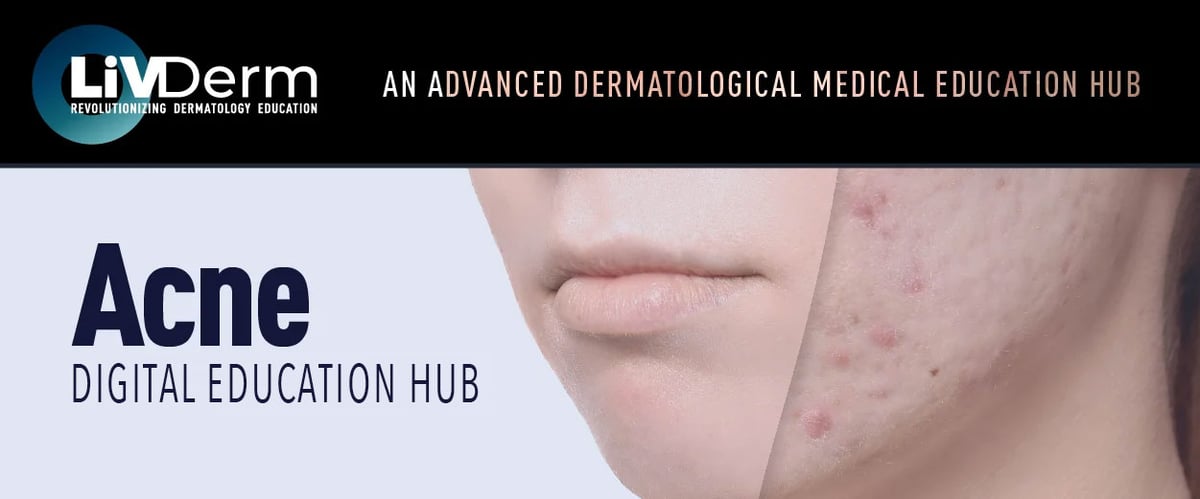 Acne Digital Education Hub
