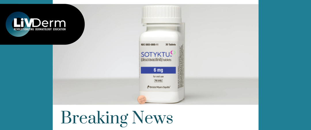 FDA Approval of Sotyktu (deucravacitinib)