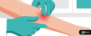 Managing Pain and Inflammation