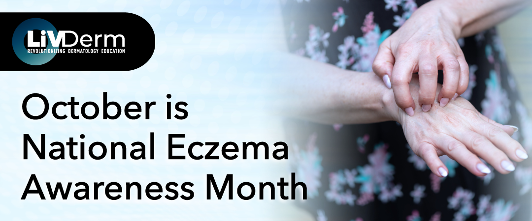 October is National Eczema Awareness Month