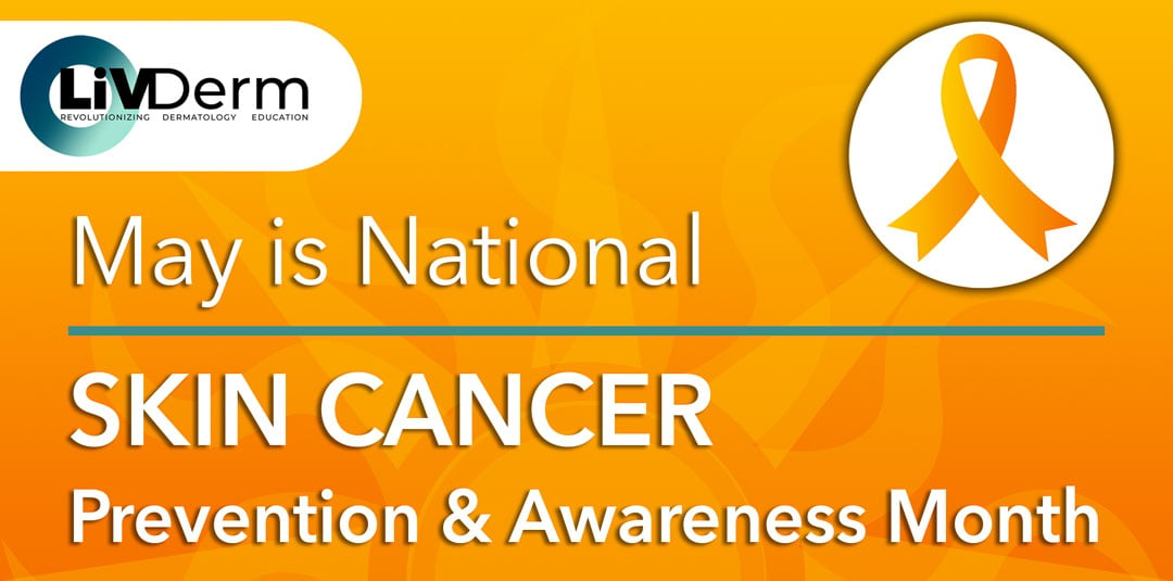 Skin Cancer Prevention & Awareness