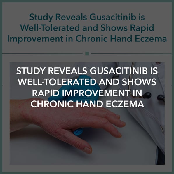 Study Reveals Gusacitinib is Well-Tolerated and Shows Rapid Improvement in Chronic Hand Eczema