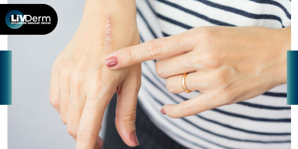 Study Suggests Bovine Sialoglycoproteins Could Be Effective in Anti-Aging, Wound Healing