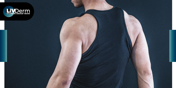 'Traptox' is trending: People are injecting their trapezius muscles with Botox: Is it safe?